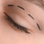 Lire la suite à propos de l’article Blépharoplastie Tunisie : ce que vous devez connaître avant de consulter