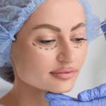 Lire la suite à propos de l’article Chirurgie des paupières : tout ce qu’il faut savoir avant l’intervention