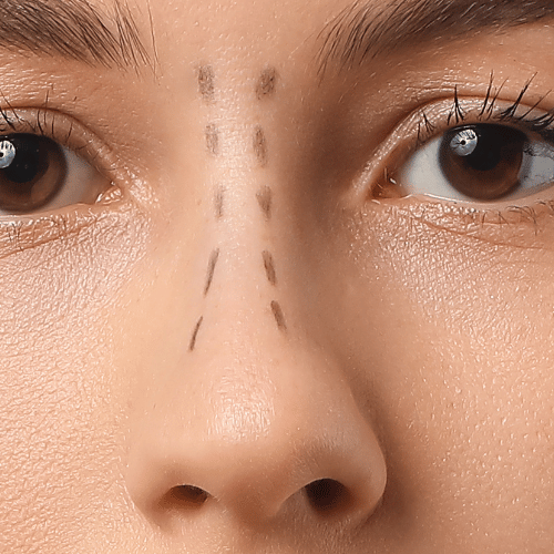 Lire la suite à propos de l’article Les étapes essentielles du processus de guérison post-rhinoplastie