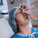 Lire la suite à propos de l’article Blépharoplastie : indications, techniques et résultats attendus